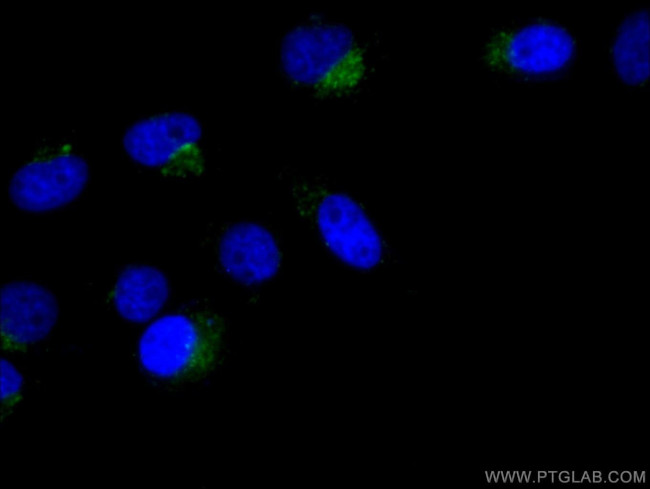 CD107a/LAMP1 Antibody in Immunocytochemistry (ICC/IF)