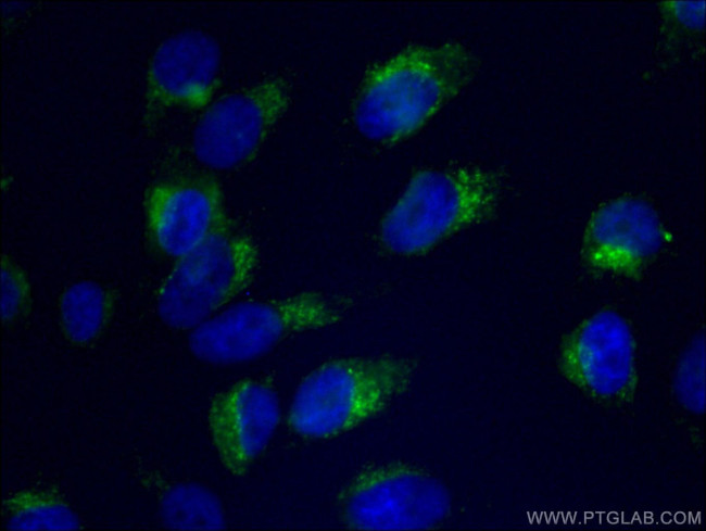 CD107b/LAMP2 Antibody in Immunocytochemistry (ICC/IF)