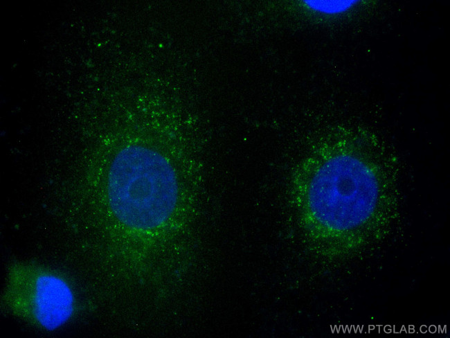 EPHX2 Antibody in Immunocytochemistry (ICC/IF)