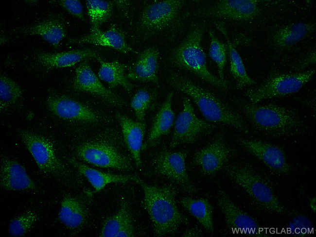 TSG101 Antibody in Immunocytochemistry (ICC/IF)