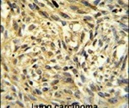 FKBP14 Antibody in Immunohistochemistry (IHC)