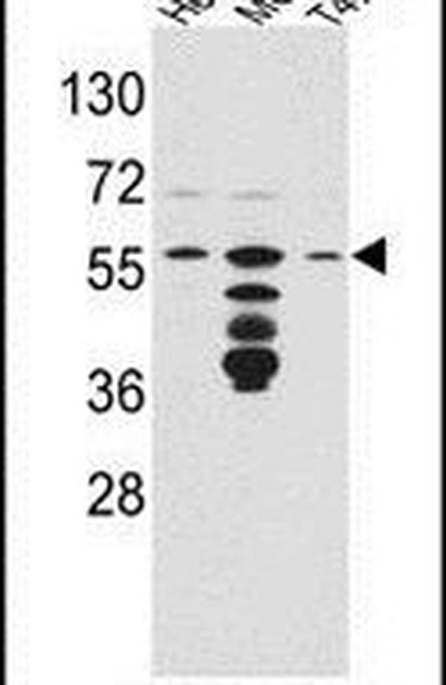 FKBP4 Antibody in Western Blot (WB)
