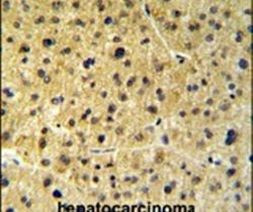 FKBP9 Antibody in Immunohistochemistry (IHC)