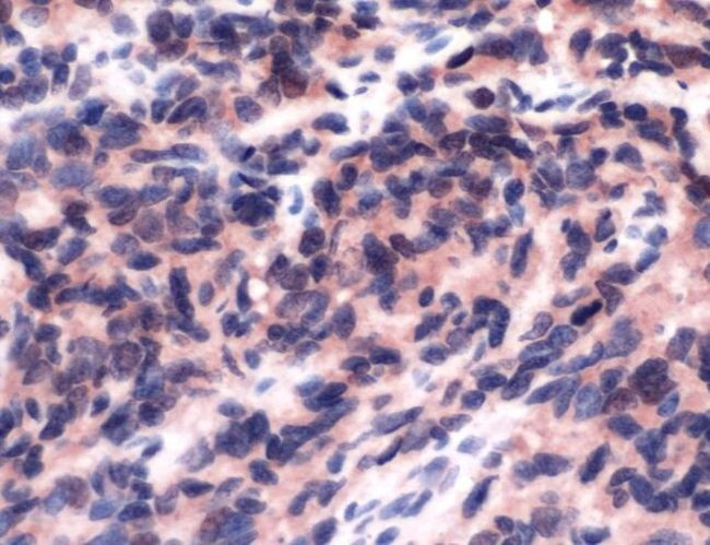 FLI1 Antibody in Immunohistochemistry (IHC)