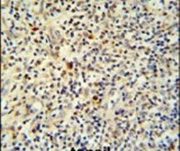 FLI1 Antibody in Immunohistochemistry (IHC)