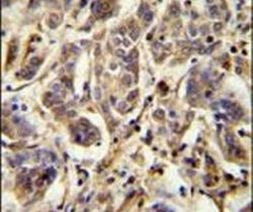 AAGAB Antibody in Immunohistochemistry (IHC)