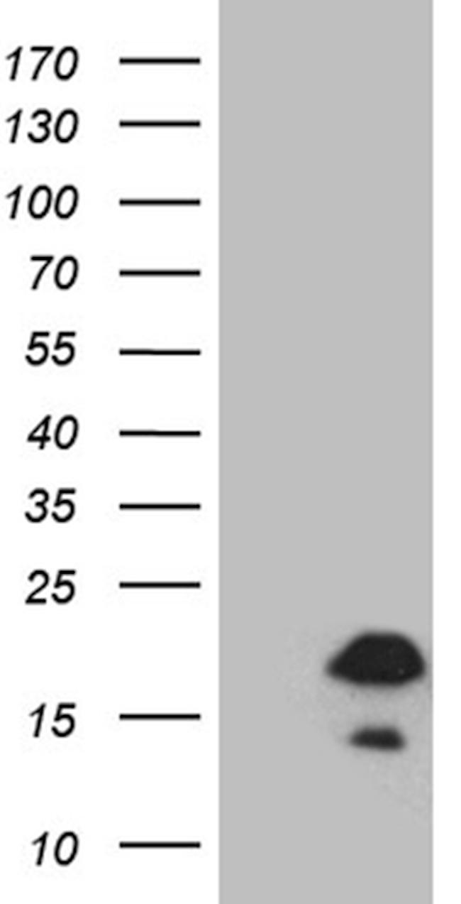FLJ33360 Antibody in Western Blot (WB)