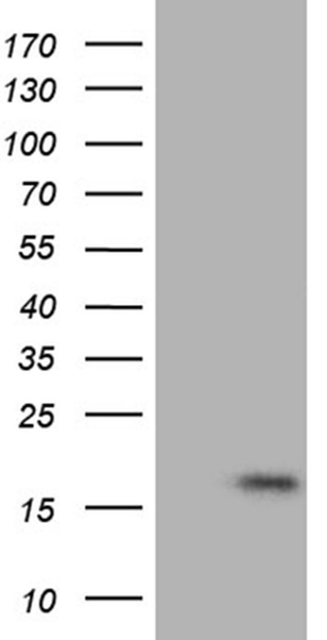 FLJ33360 Antibody in Western Blot (WB)