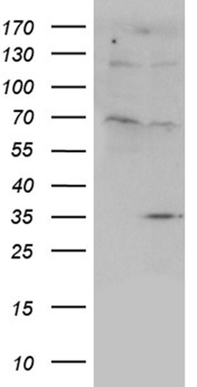 FLJ40504 Antibody in Western Blot (WB)