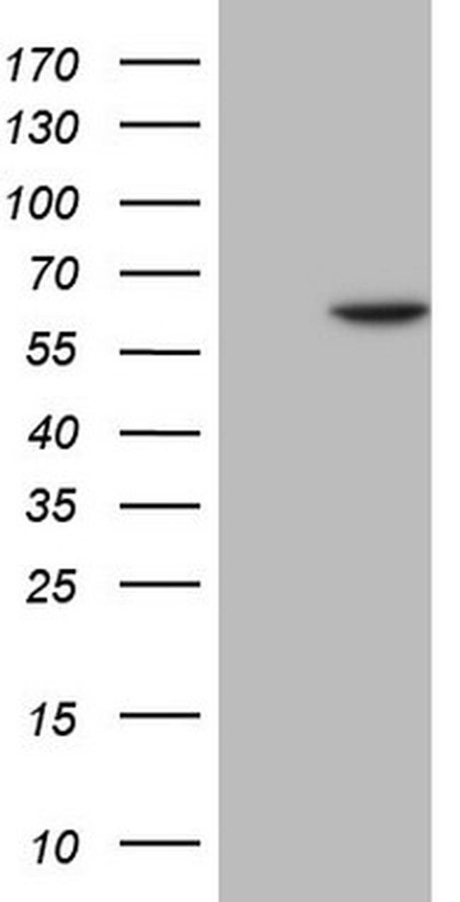 FLT1 Antibody in Western Blot (WB)