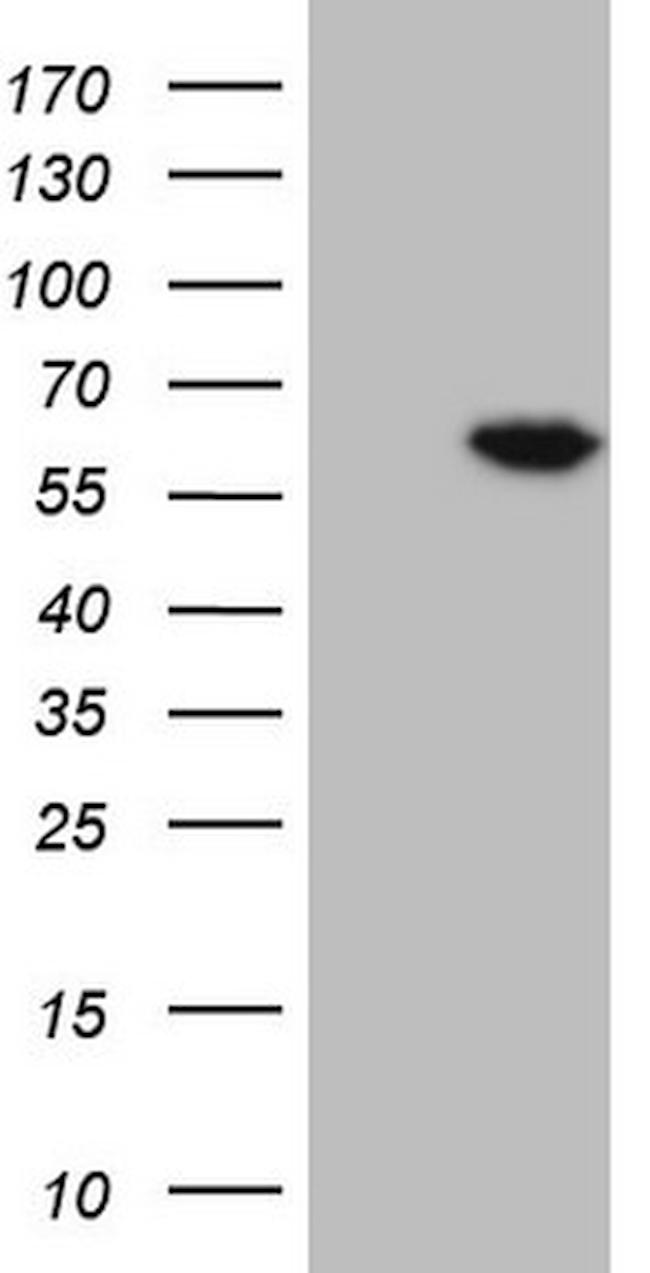 FLT1 Antibody in Western Blot (WB)