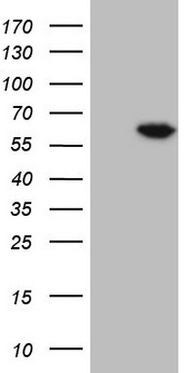 FLT1 Antibody in Western Blot (WB)