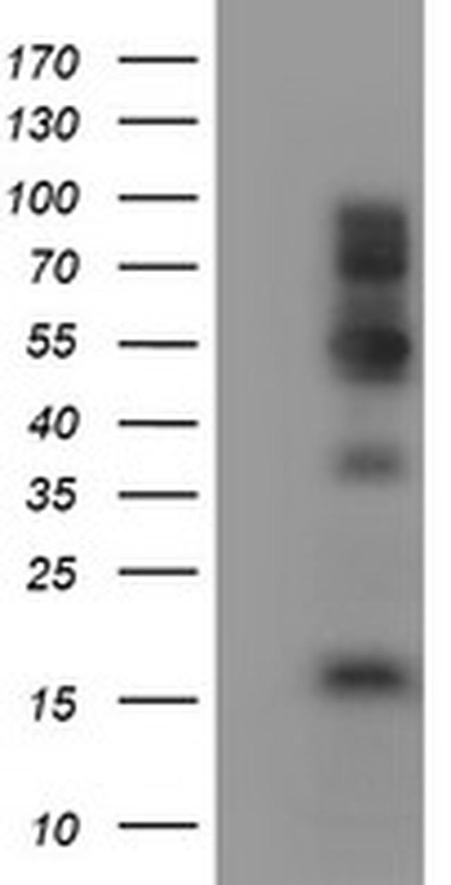 FMR1 Antibody in Western Blot (WB)
