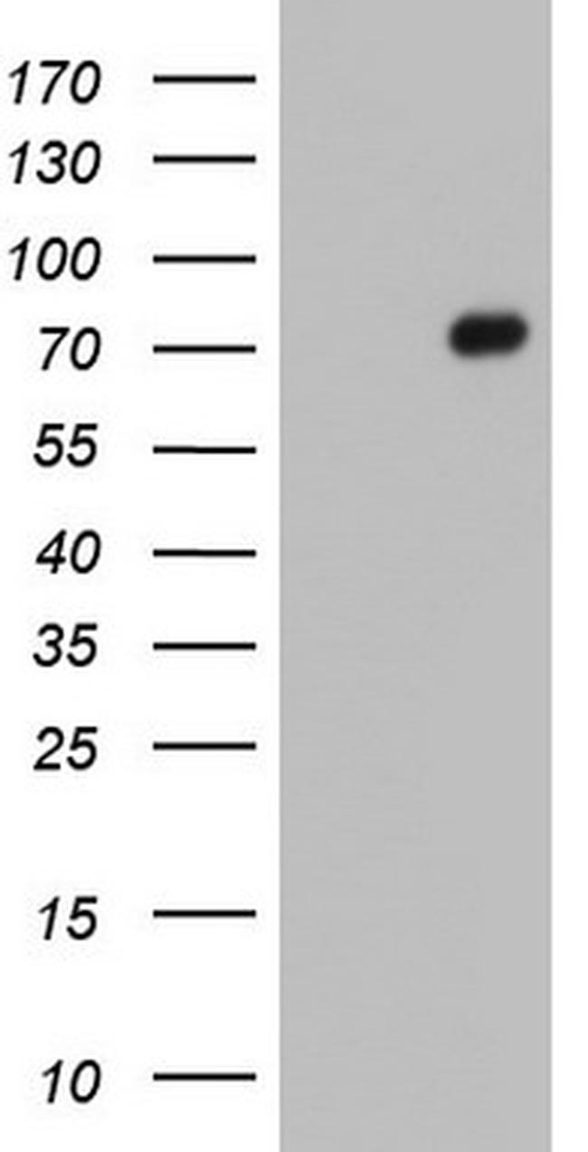 FN1 Antibody in Western Blot (WB)
