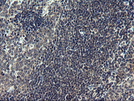 FNDC8 Antibody in Immunohistochemistry (Paraffin) (IHC (P))