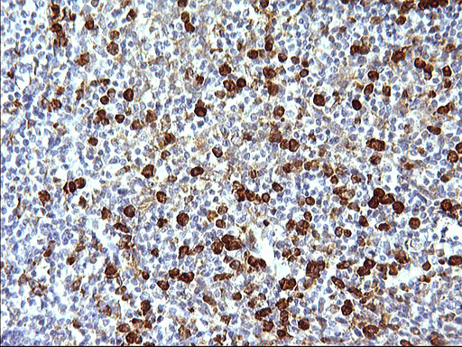 FNDC8 Antibody in Immunohistochemistry (Paraffin) (IHC (P))