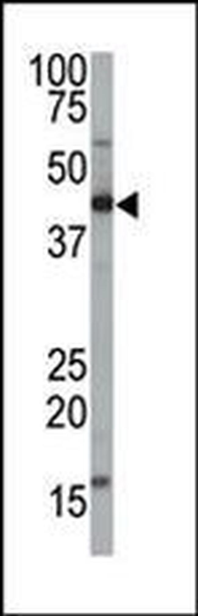 FNTA Antibody in Western Blot (WB)