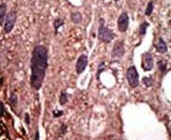 FNTB Antibody in Immunohistochemistry (IHC)