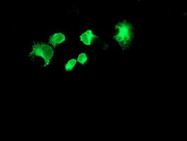 FOLH1 Antibody in Immunocytochemistry (ICC/IF)