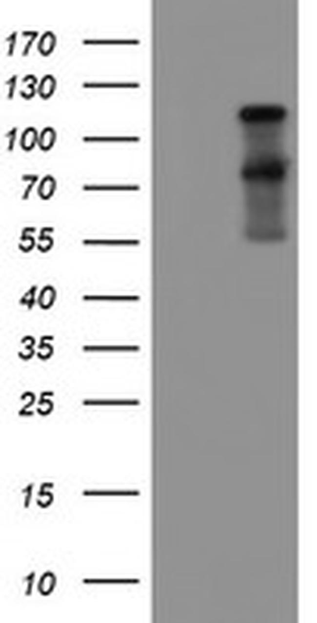 FOLH1 Antibody in Western Blot (WB)