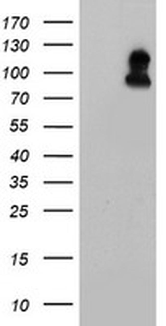 FOLH1 Antibody in Western Blot (WB)