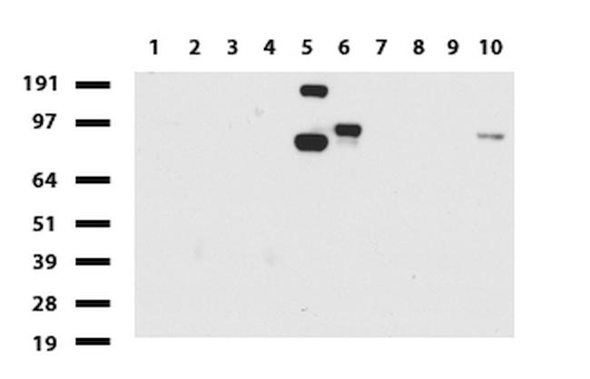 FOLH1 Antibody in Western Blot (WB)