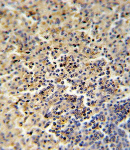 FOLR2 Antibody in Immunohistochemistry (IHC)