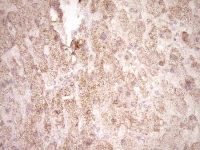 FOS Antibody in Immunohistochemistry (Paraffin) (IHC (P))