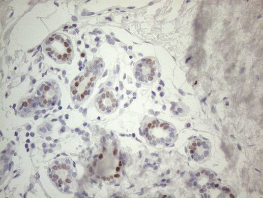 FOS Antibody in Immunohistochemistry (Paraffin) (IHC (P))