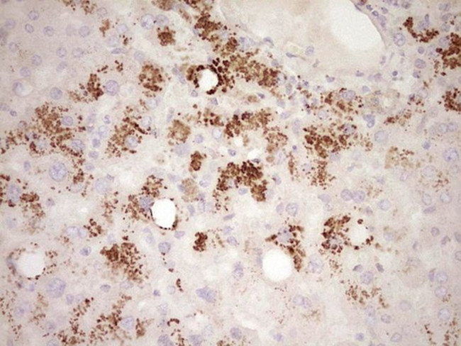 FOS Antibody in Immunohistochemistry (Paraffin) (IHC (P))