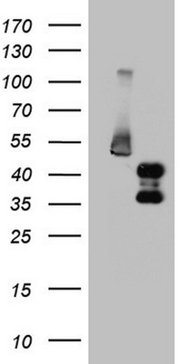 FOSB Antibody in Western Blot (WB)