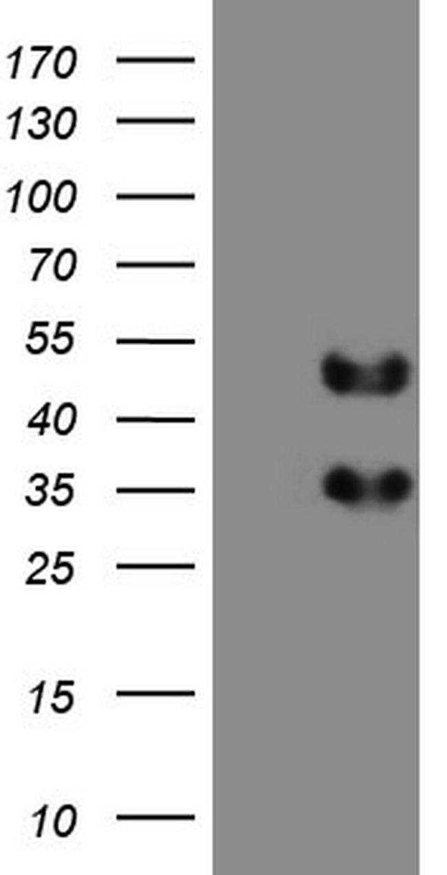 FOSB Antibody in Western Blot (WB)