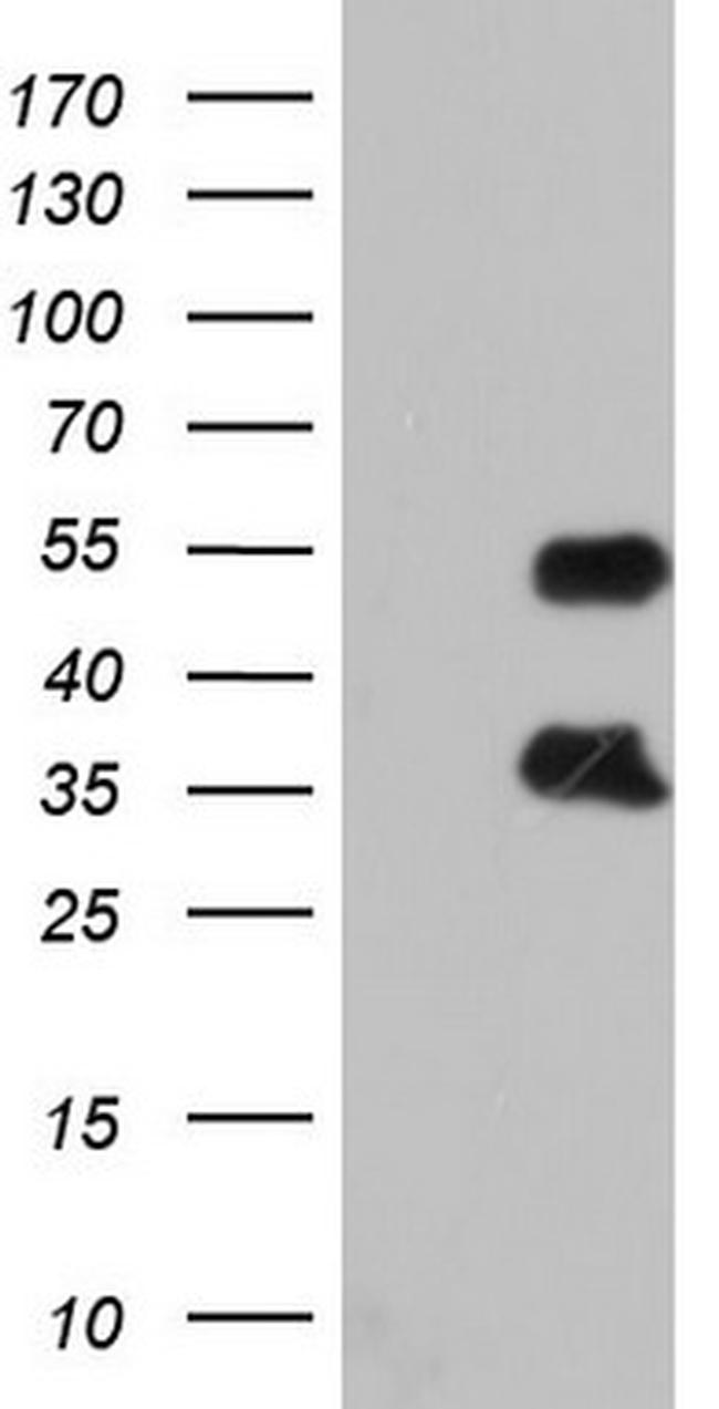 FOSB Antibody in Western Blot (WB)