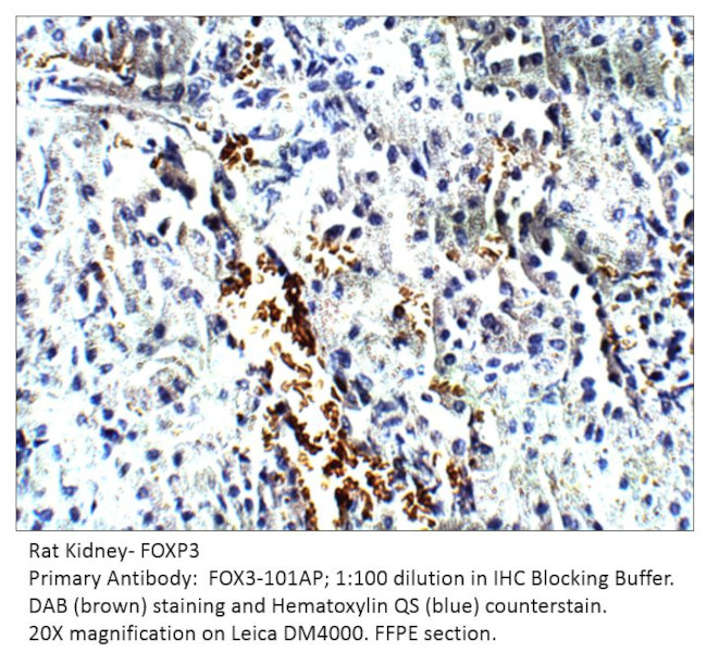 FOXP3 Antibody in Immunohistochemistry (IHC)