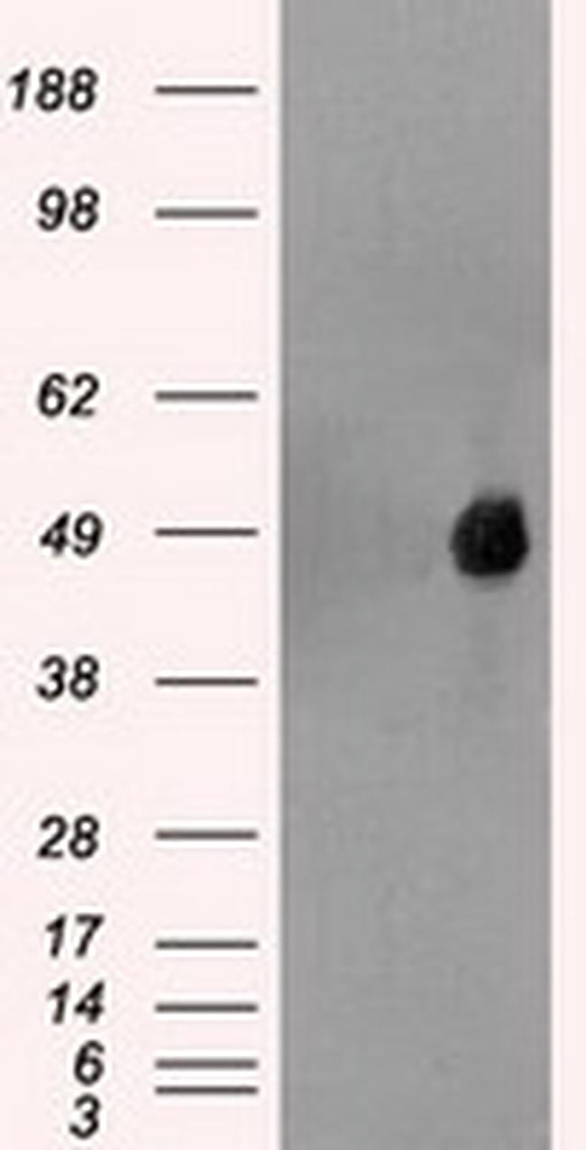 FOXA1 Antibody in Western Blot (WB)