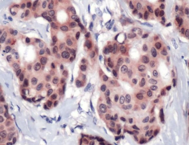 FOXA1 Antibody in Immunohistochemistry (IHC)