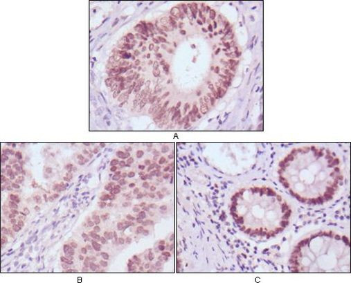 FOXA2 Antibody in Immunohistochemistry (Paraffin) (IHC (P))