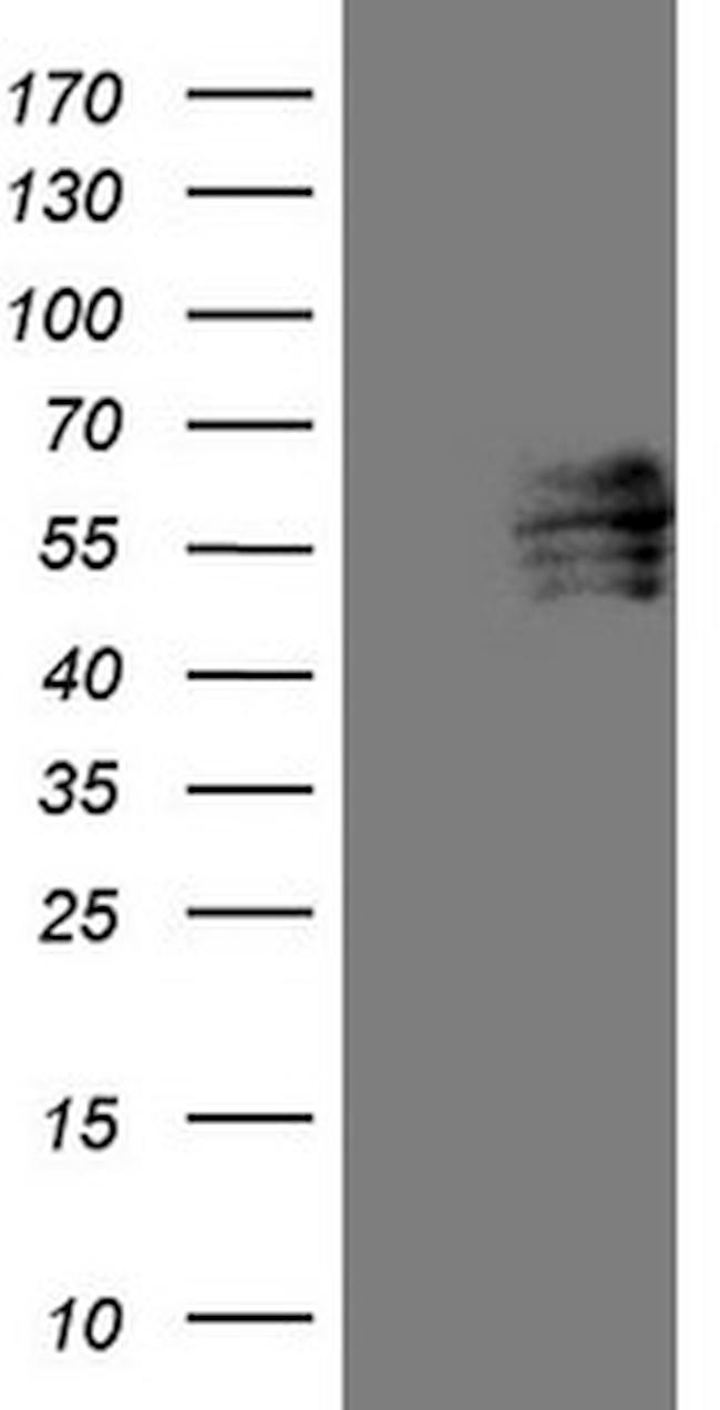 FOXC2 Antibody in Western Blot (WB)