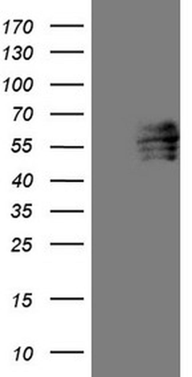 FOXC2 Antibody in Western Blot (WB)