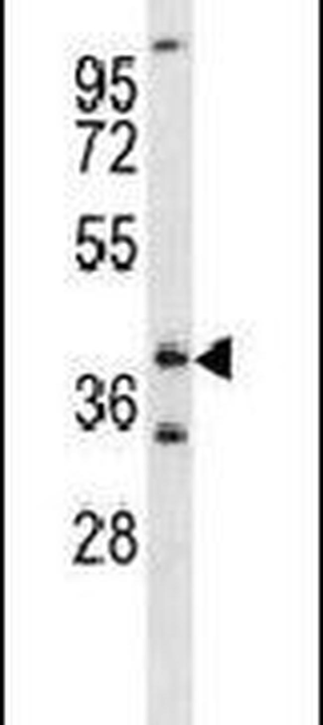 FOXL1 Antibody in Western Blot (WB)