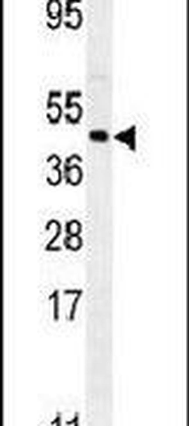 FOXL2 Antibody in Western Blot (WB)