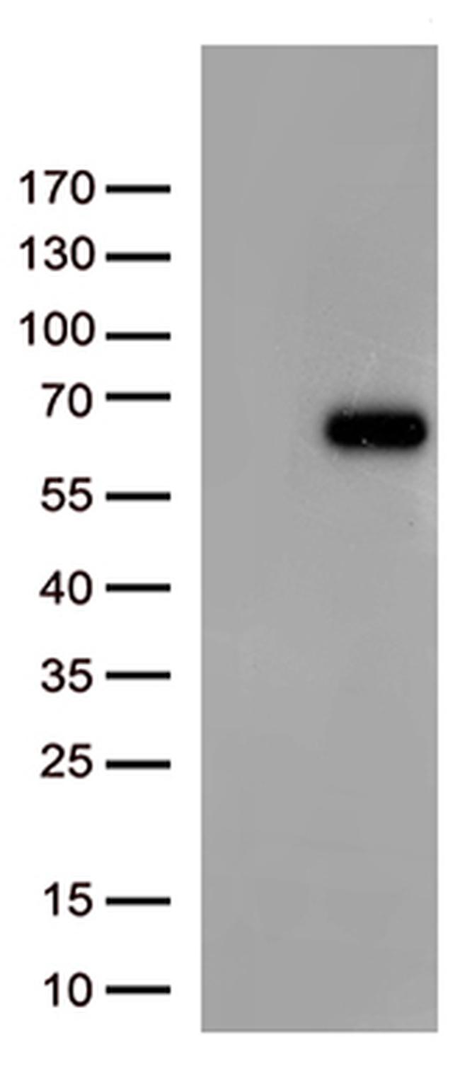 FOXN2 Antibody in Western Blot (WB)
