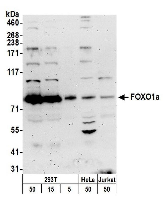FOXO1a Antibody in Western Blot (WB)