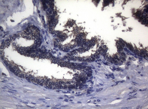 FOXO3 Antibody in Immunohistochemistry (Paraffin) (IHC (P))
