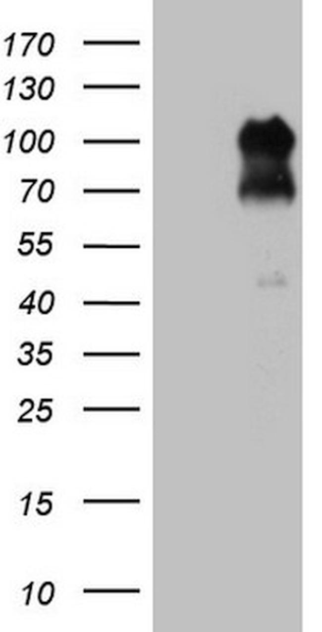 FOXO3 Antibody in Western Blot (WB)
