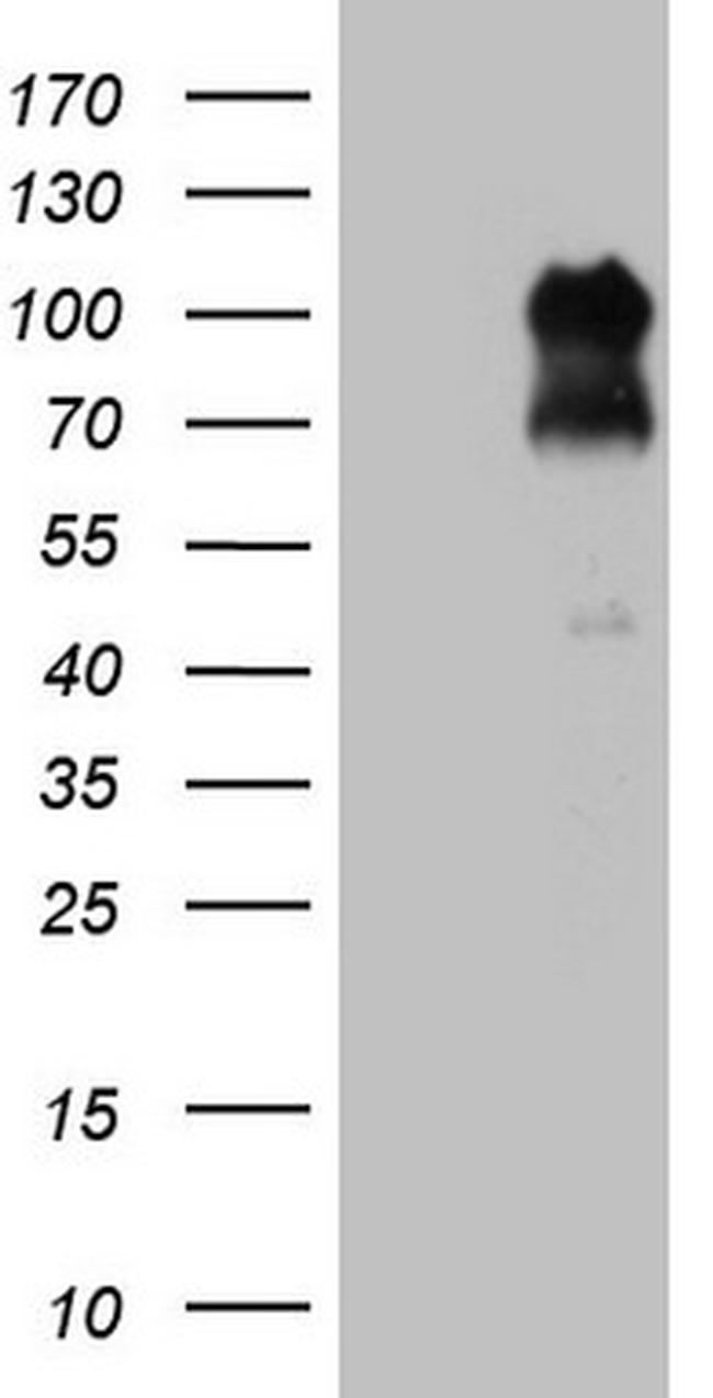 FOXO3 Antibody in Western Blot (WB)