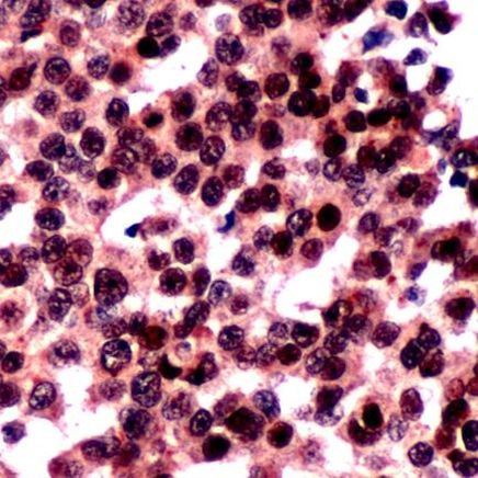 FOXO3A Antibody in Immunohistochemistry (IHC)