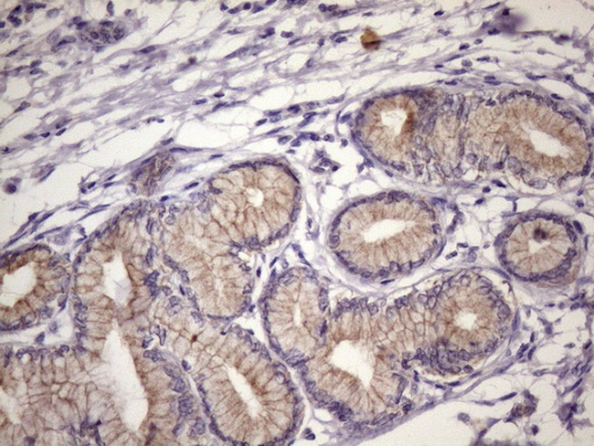 FOXO4 Antibody in Immunohistochemistry (Paraffin) (IHC (P))