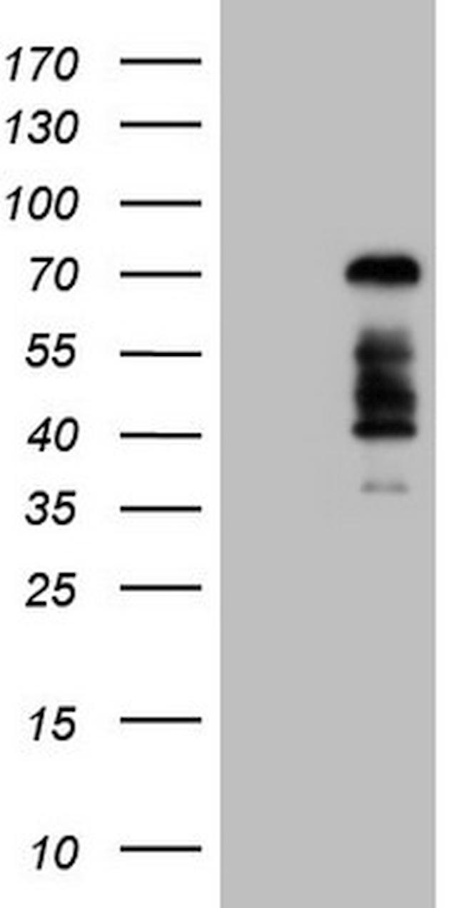 FOXO4 Antibody in Western Blot (WB)
