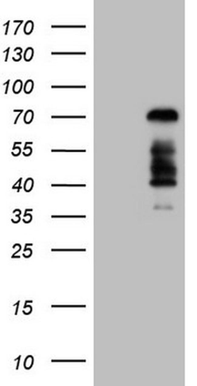 FOXO4 Antibody in Western Blot (WB)